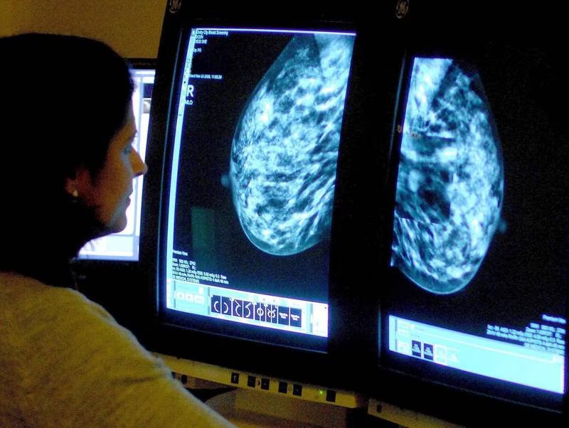 Arab Health: Early screening ‘best weapon’ in fight against cancer