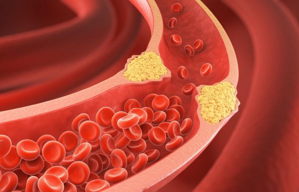 أساسيات صحة القلب: فهم دور الكوليسترول في جسمك
