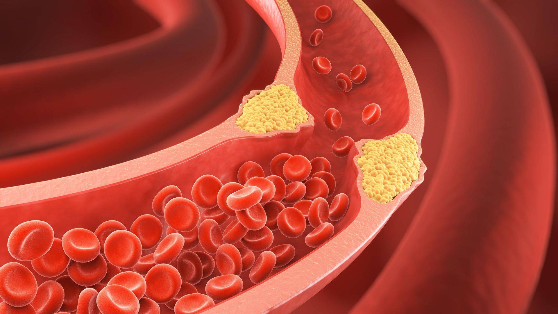 Heart Health 101: Understanding Cholesterol's Role in Your Body – Sheikh  Shakhbout Medical City Abu Dhabi