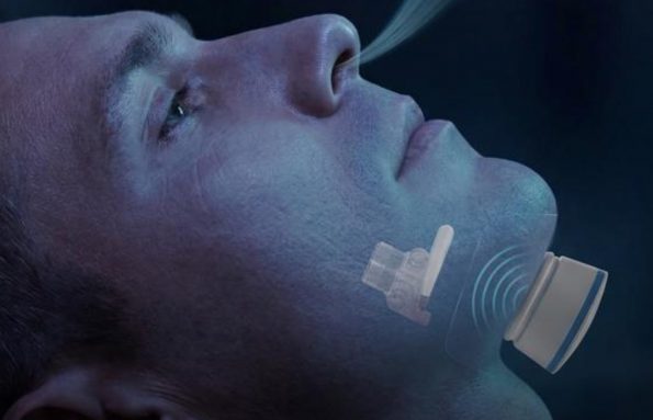 Sheikh Shakhbout Medical City Introduces Implantable Hypoglossal Nerve Stimulation Therapy with Obstructive Sleep Apnoea