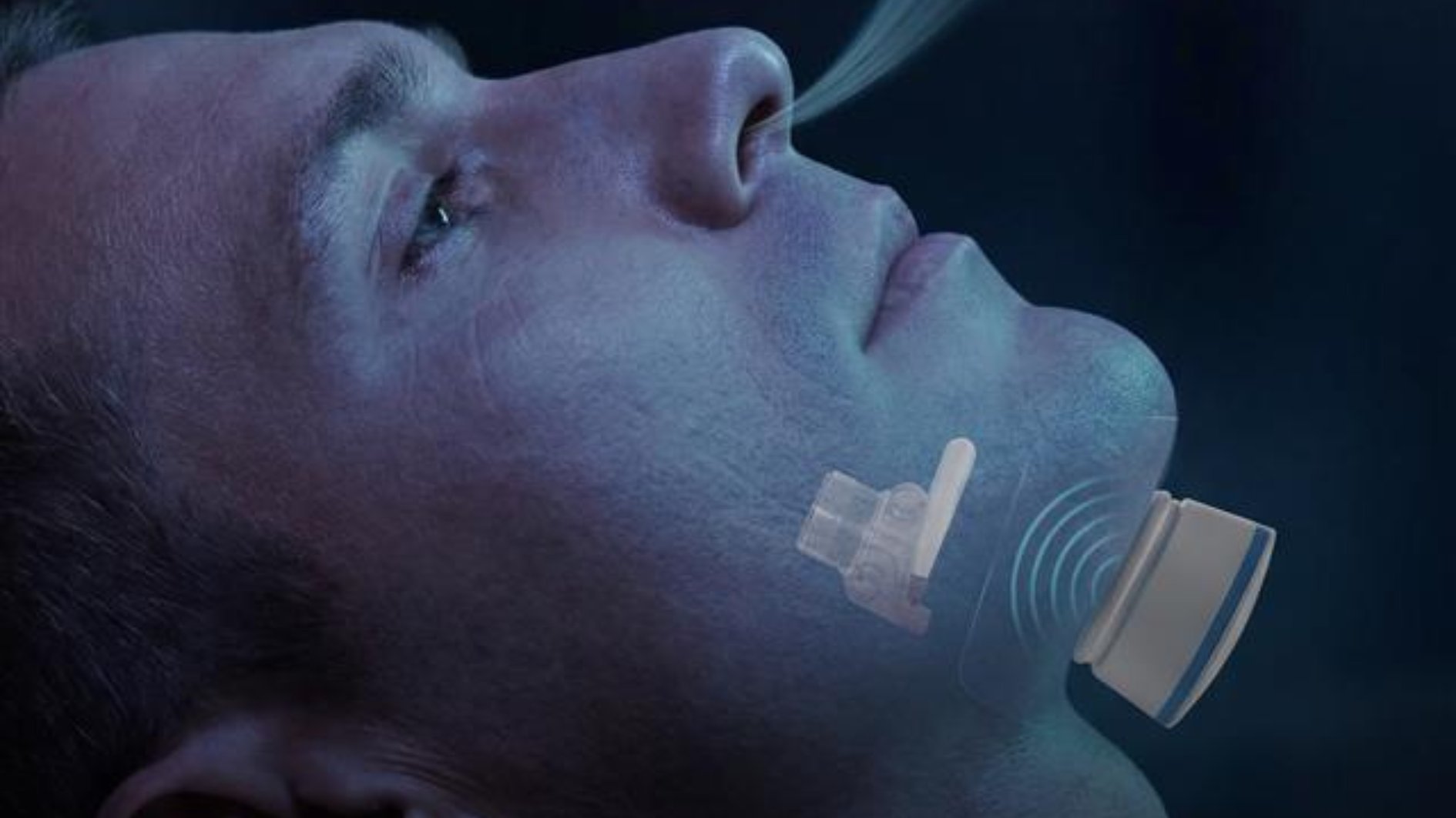 مدينة الشيخ شخبوط الطبية تقدم خياراً علاجياً جديداً لمرضى انقطاع النفس الانسدادي أثناء النوم